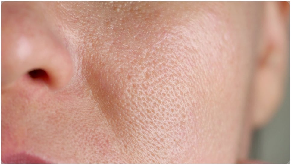 For Clean Pores at Sadang Station Aqua Peel image 3