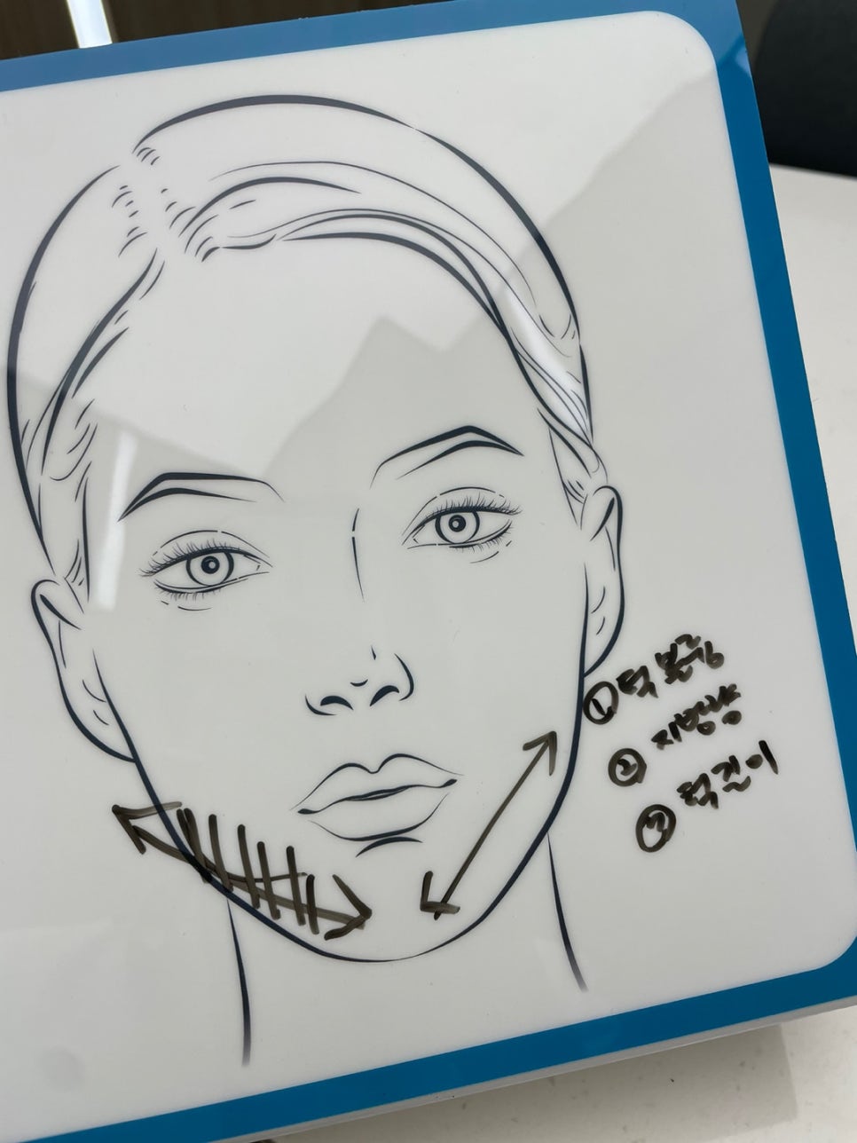 턱필러 주의할 점, 오랫동안 유지하는 방법은? 관련 이미지 5