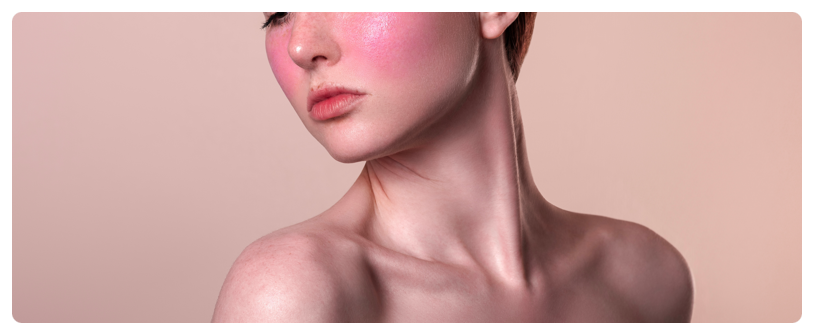 Starting with Understanding the Causes of Rosacea in Isu Station Vbeam Perfecta image 2