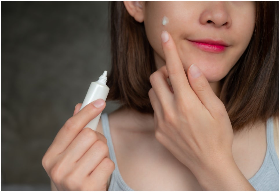 How to Respond Early to Acne Scars in Seocho-gu image 5