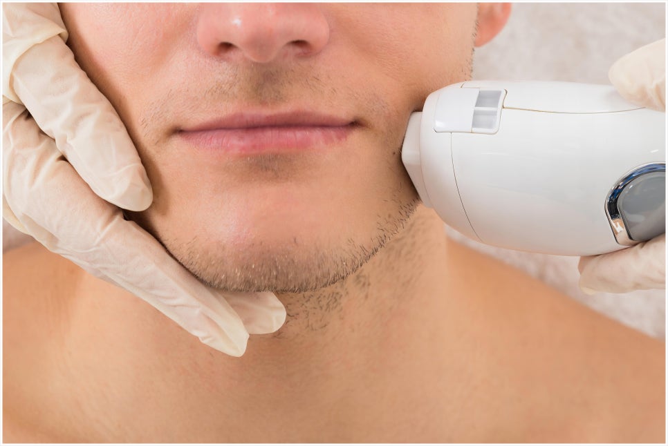 Isu Station Laser Hair Removal for a Neat Impression image 1