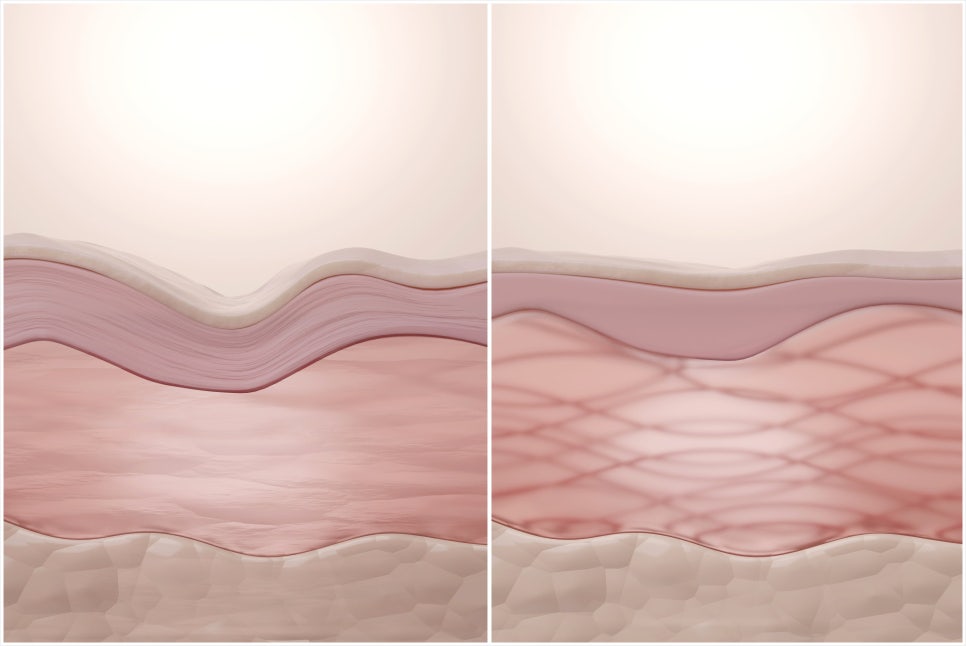 Sadang Station Onda Lifting: Reducing Pain and Increasing Results with a Cooling System image 3