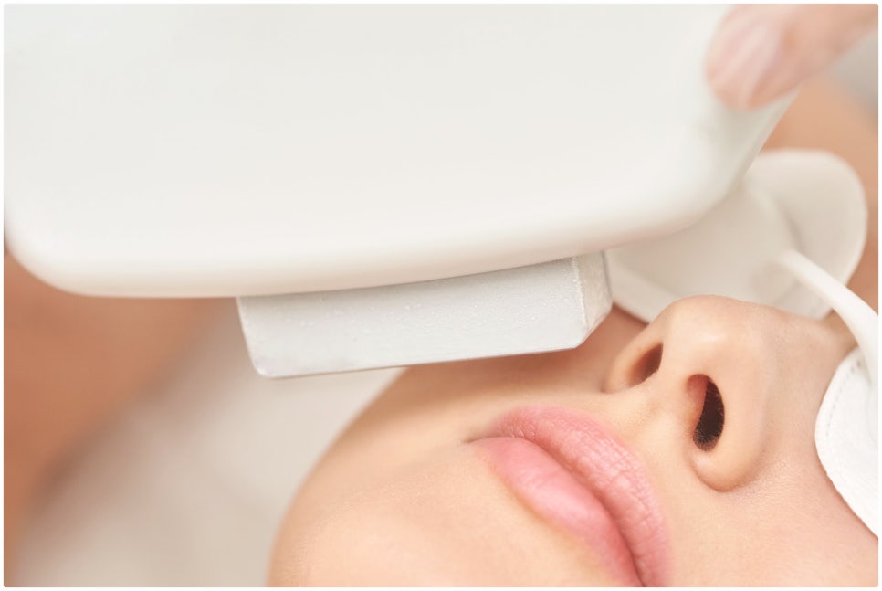 Sadang Station Sunday Dermatology Clinic: Ultherapy Prime with Upgraded Equipment image 2