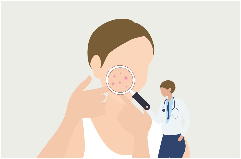 Potenza at Sadang Station: Is This Treatment Suitable for My Skin Concerns? image 3