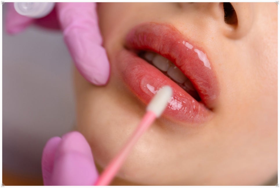 Bangbae Station Lip Filler: Natural and Full of Volume image 4