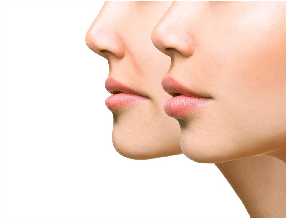 Bangbae-dong Juvelook Volume: If You Want a Natural Change image 1