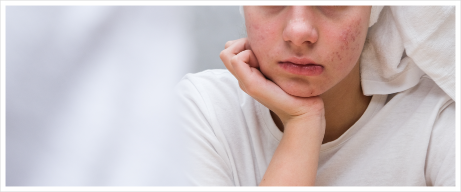Bangbaeyeok Curet: Reducing the Burden of Pain While Treating Acne Scars image 1