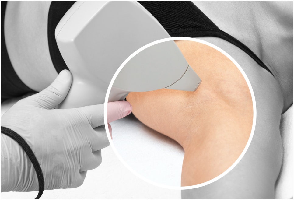 Laser Hair Removal in Seocho-gu: If Dark Stubble Is Bothering You image 2