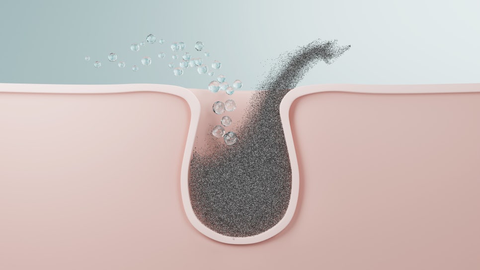 Managing Pores in Summer with Aquapeel Near Bangbae Station image 4