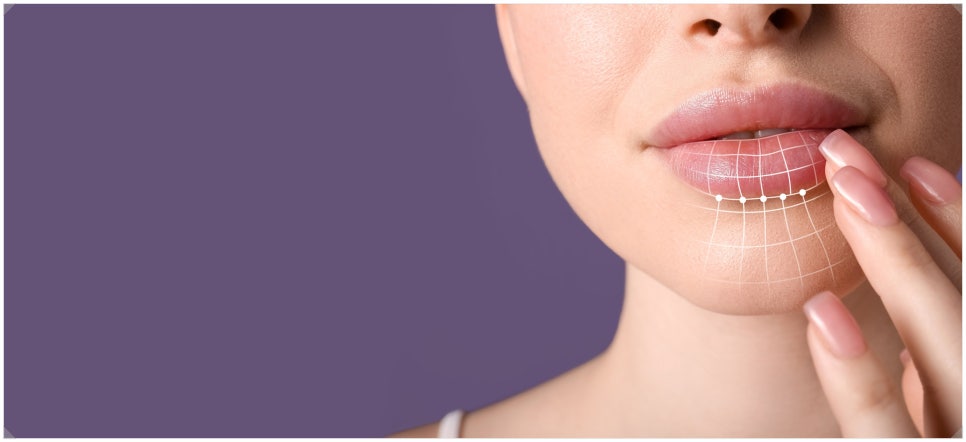 Bangbae Station Lip Filler: Natural and Full of Volume image 3