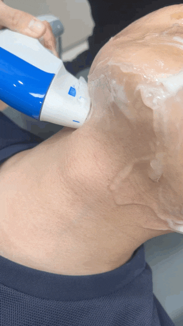 사당역 피부과 효과적인 리프팅 슈링크 유니버스 관련 이미지 9