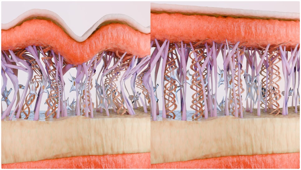 To See the Effects of Bangbaedong Onda Lifting image 1