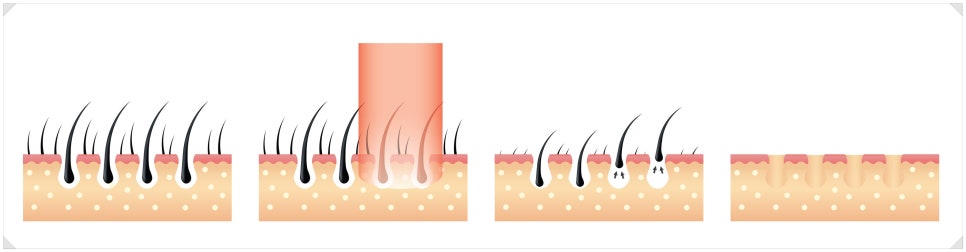 서초구젠틀맥스프로플러스, 업그레이드된 장비로 깔끔하게 관련 이미지 1