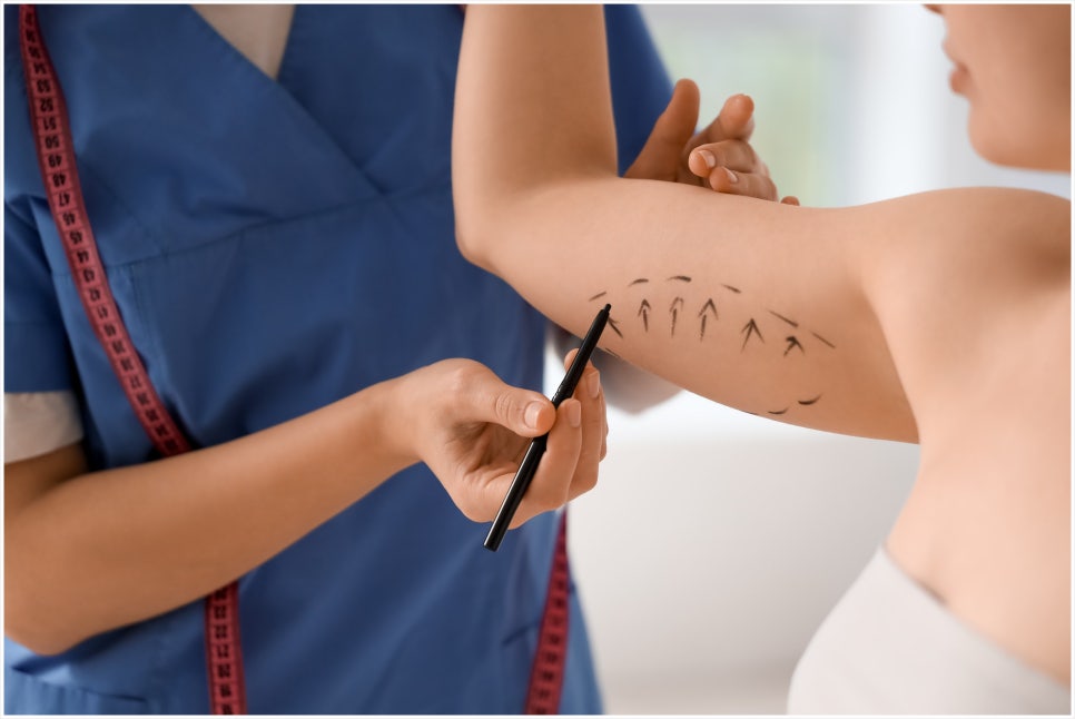 Isu Station Body Onda: A Treatment That Can Be Performed Not Only on the Face but Also on the Body image 2