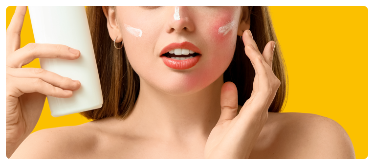Starting with Understanding the Causes of Rosacea in Isu Station Vbeam Perfecta image 4