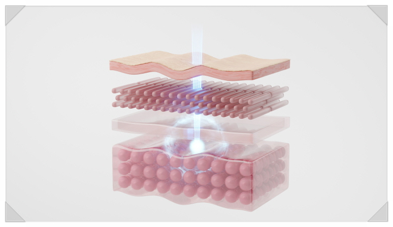 Banpo-dong Ulthera Prime: How Is the Upgraded Device Different from the Existing Ulthera? image 2