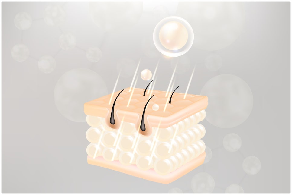 Sadang Station Male Laser Hair Removal with the New GentleMax Pro Plus image 2