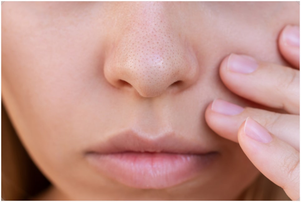 For Clean Pores at Sadang Station Aqua Peel image 1
