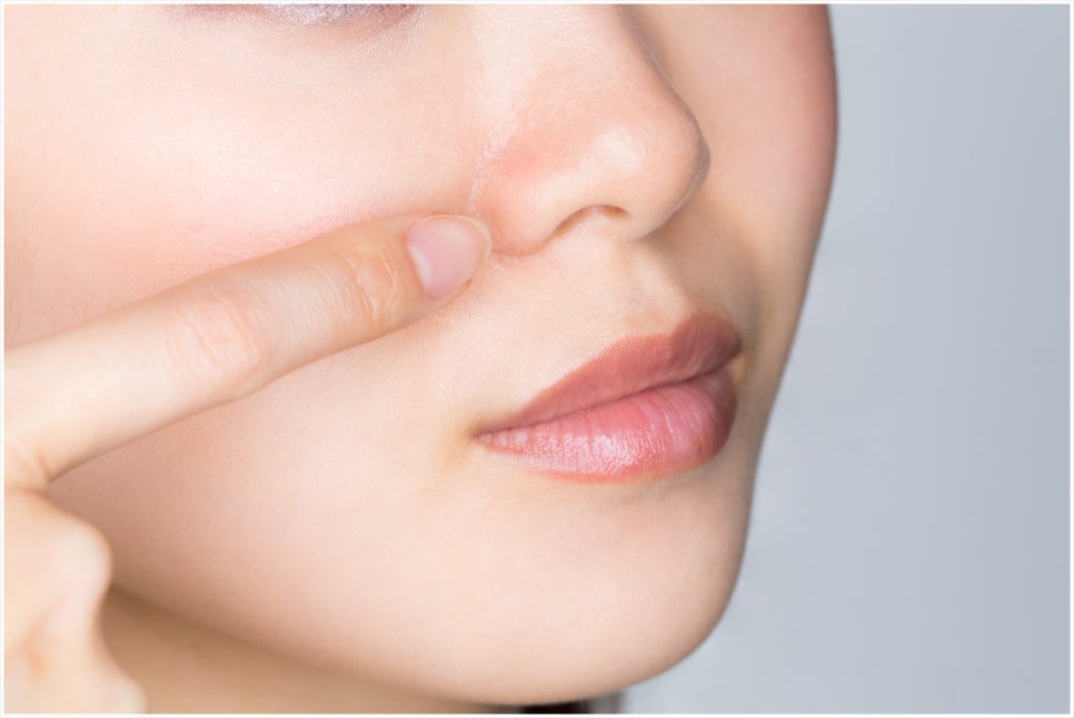 Isu Station Secret Laser for When Pores Are a Concern image 6