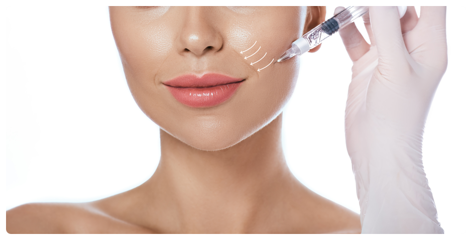 Reliable Nasolabial Fold Filler in Seocho-gu image 1