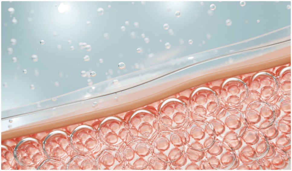 Sadang Station Sunday Dermatology Clinic: Ultherapy Prime with Upgraded Equipment image 1
