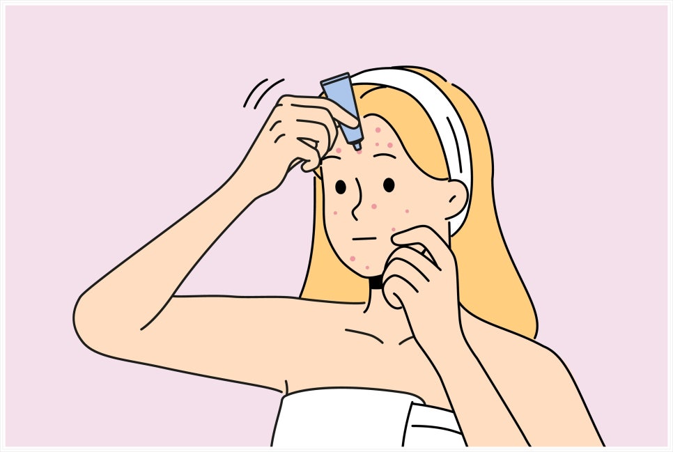If You Are Feeling Stressed About Acne Treatment in Bangbaedong image 12