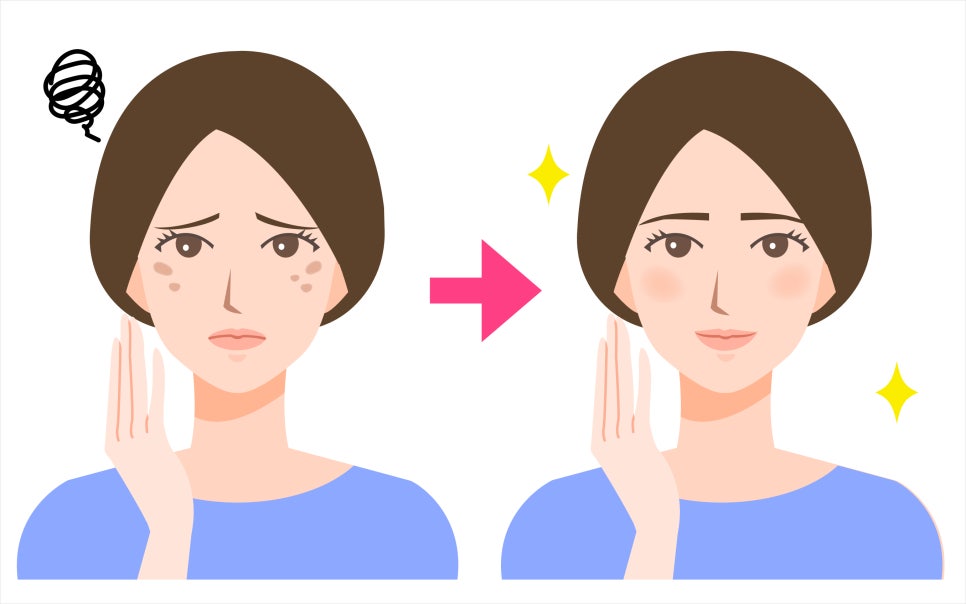 사당역기미치료 한겨울에도 관리가 필요한 관련 이미지 1