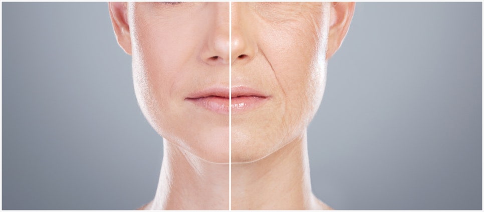 If You Want a Youthful Face with Skin Botox in Seocho-gu image 6