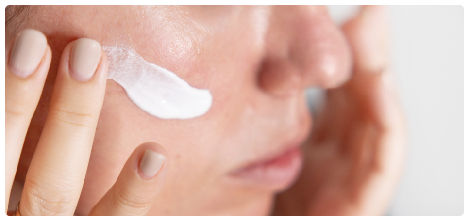 Seocho-gu Vbeam, a Choice for Treating Facial Redness image 3