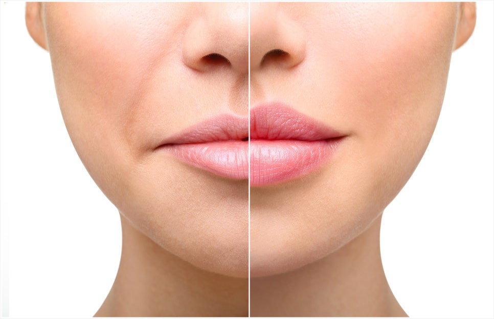 Bangbae-dong Juvelook Volume: If You Want a Natural Change image 8