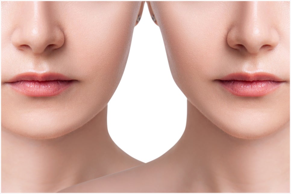 If You’re Worried About a Square Jawline, Bangbae-dong Jaw Botox image 6