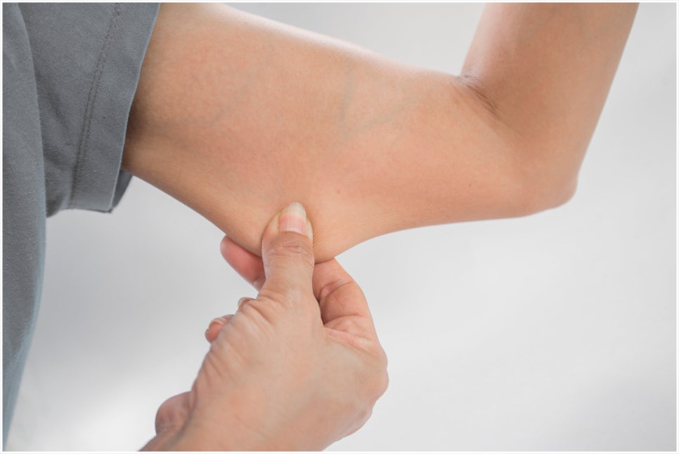 Isu Station Body Onda: A Treatment That Can Be Performed Not Only on the Face but Also on the Body image 4