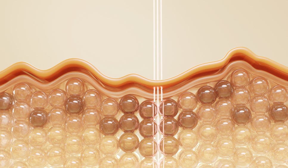 Ishuyeok Melasma Treatment, Essential in Summer image 6