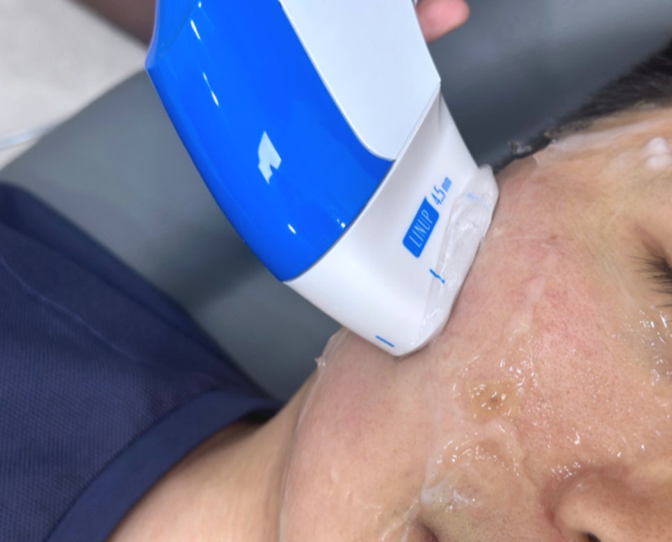 사당역 피부과 효과적인 리프팅 슈링크 유니버스 관련 이미지 3