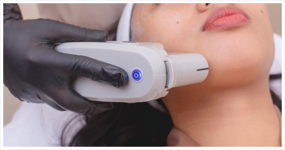 Sadang Station Ultherapy Prime, with More Refined Equipment image 3