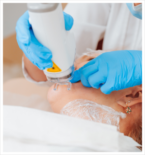 How to Respond Early to Acne Scars in Seocho-gu image 4