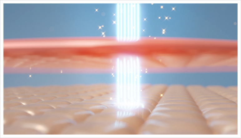 Why Sadang Station Titanium Lifting Can Deliver Tightening and Brightening at the Same Time image 3
