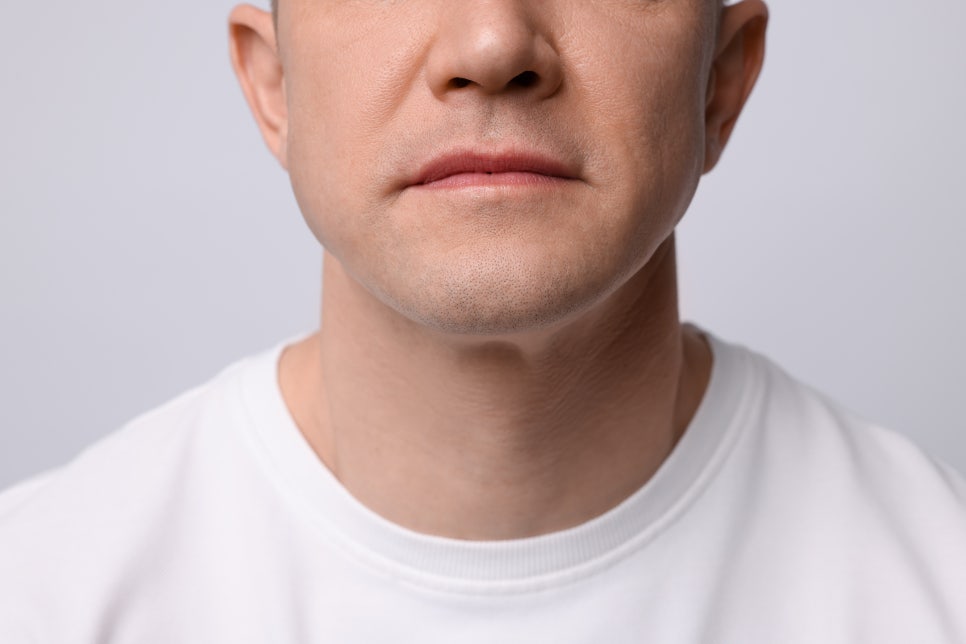 Seocho-gu Sunday Dermatology Clinic: A Neat Impression Through GentleMax Pro Plus Laser Hair Removal image 7
