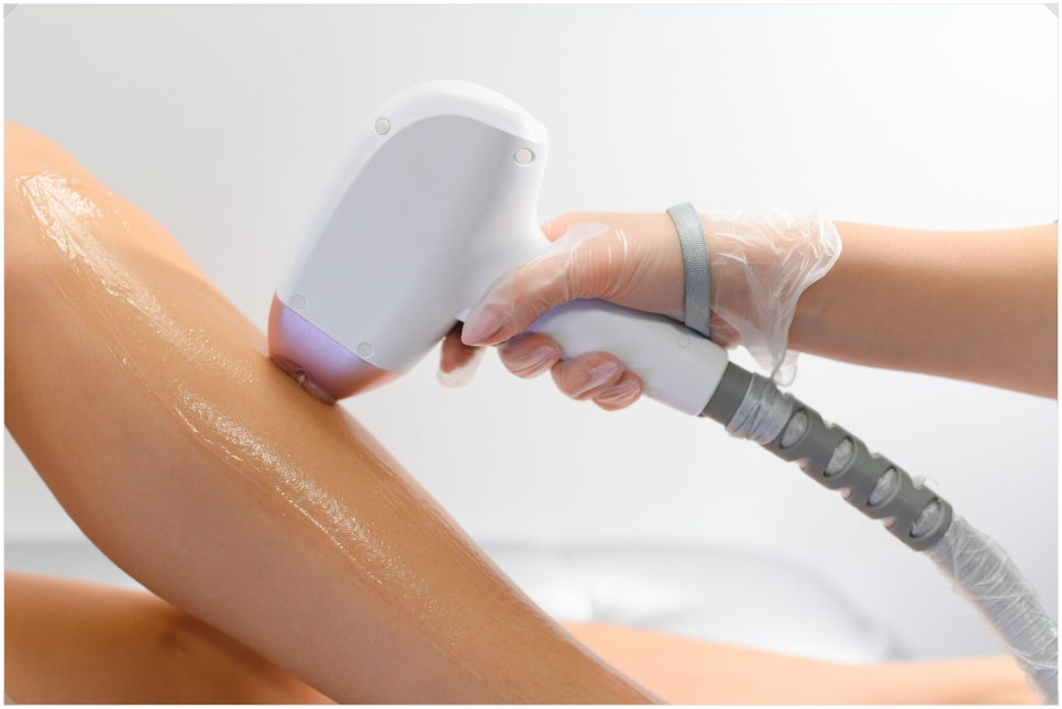 Thorough Care for Seochogu GentleMax Hair Removal, from Results to Pain Management image 2