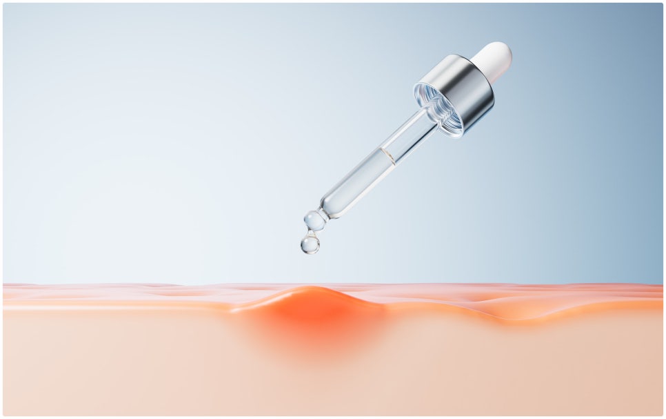 Potenza at Sadang Station: Is This Treatment Suitable for My Skin Concerns? image 4