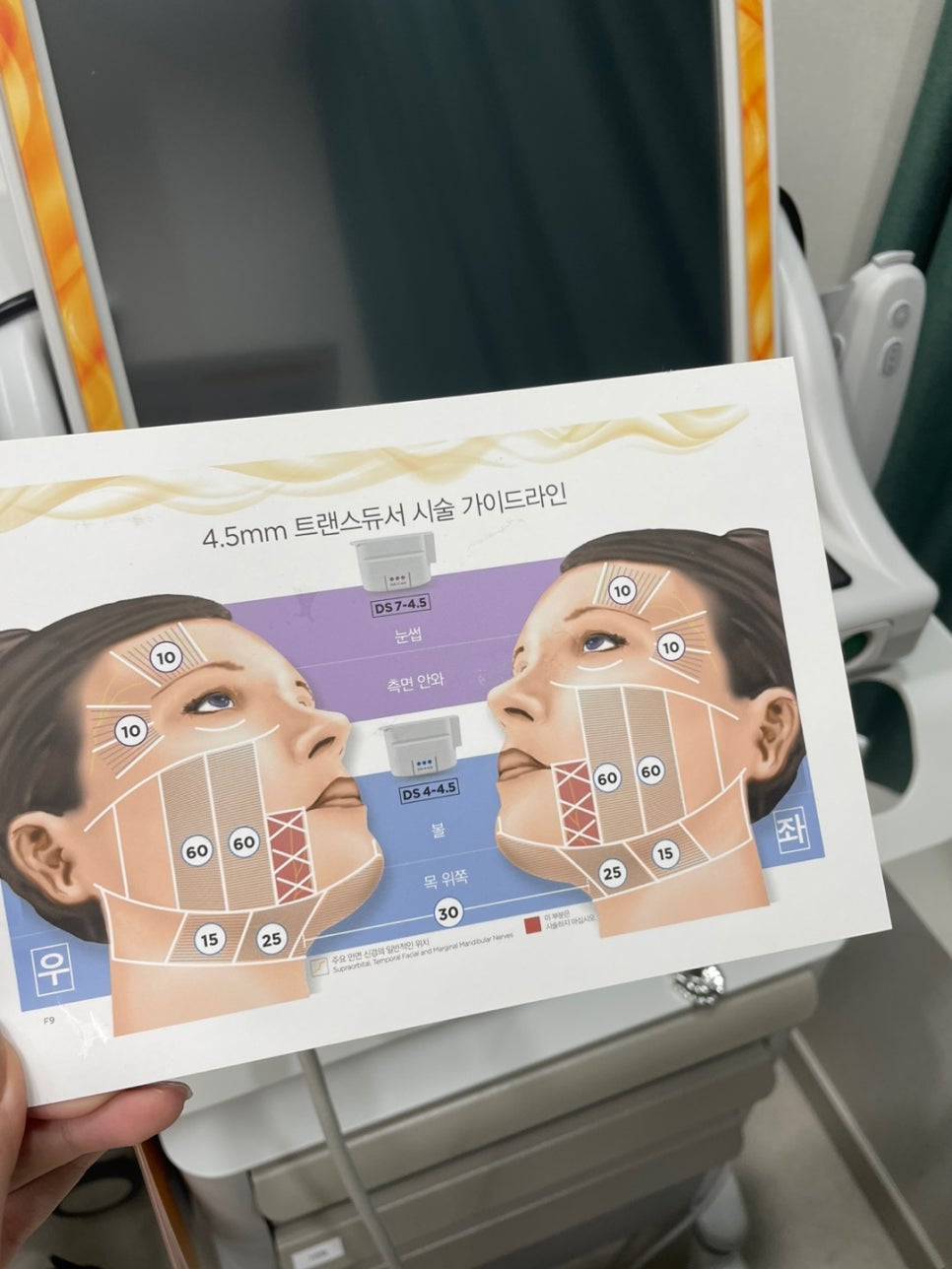 울쎄라 유지기간 300샷 600샷 차이까지 관련 이미지 8