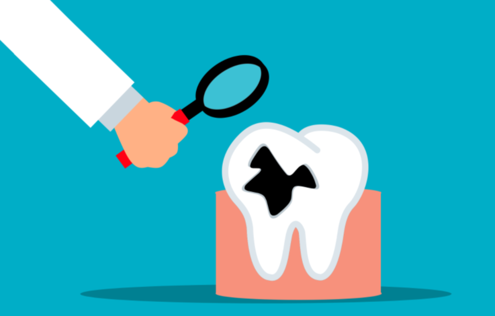 Three Problems That Can Occur If You Don’t Remove Tartar at an Apgujeong Dental Clinic image 6