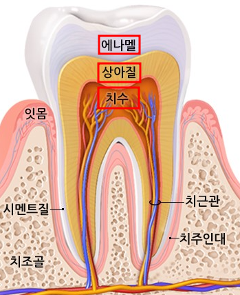 서초구치과 충치 치료 확실히 끝내고 싶다면 이것 보세요 관련 이미지 4