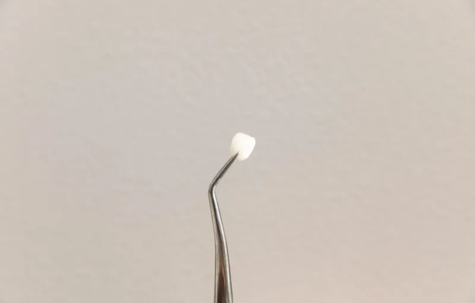 Shinsa Station Dental Clinic, Shinseong Dental Clinic: 4 Side Effects You Must Check Before Getting Laminates image 4