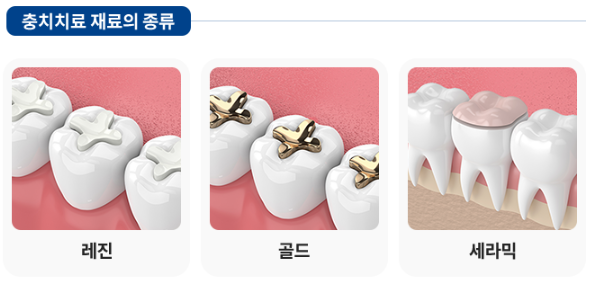 논현역치과 신성치과 충치 치료도 제대로 받아야 합니다. 관련 이미지 6