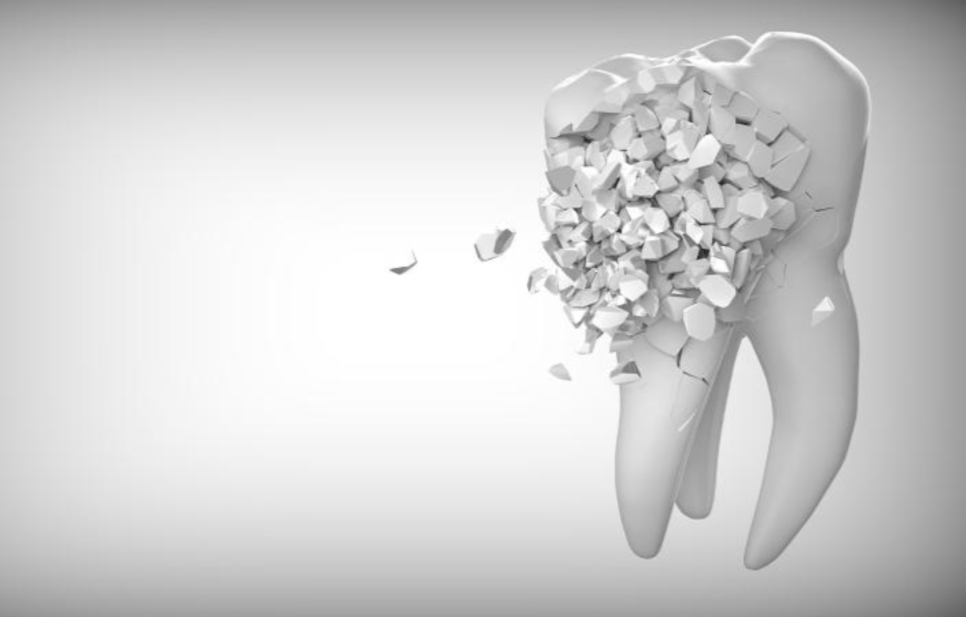 Shinsa Station Dental Clinic, Shinseong Dental Clinic: 4 Side Effects You Must Check Before Getting Laminates image 7