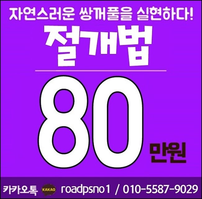 화곡동쌍꺼풀수술 자연스럽게 아름다워진 눈매 로드성형외과! 관련 이미지 3