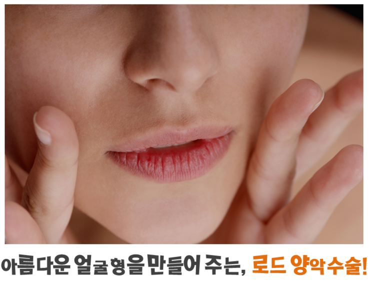 ​[아이리스/로드성형외과] 강서양악수술잘하는곳 ♬ 관련 이미지 2