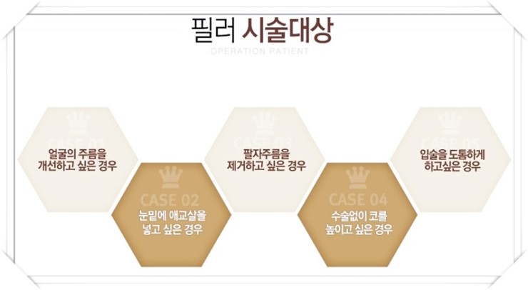 화곡동코필러 내가 찾던 결과 관련 이미지 4