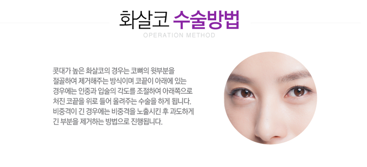 [화곡성형외과 로드성형외과에서 알려드리는 화살코성형 정보 ♬] 관련 이미지 3